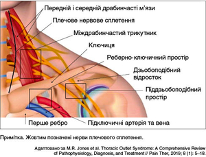 Рисунок. Анатомічні зони, залучені до патофізіології СГВ